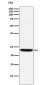 Anti-Tetranectin Rabbit Monoclonal Antibody